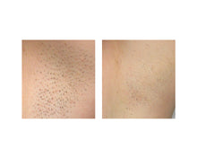 Load image into Gallery viewer, Underarms