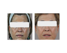 Load image into Gallery viewer, Cheeks - 3 Sessions